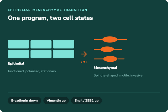 EMT markers — epithelial-mesenchymal transition: junctioned epithelial sheet becomes spindle-shaped mesenchymal cells; E-cadherin down, vimentin up, Snail/ZEB1 up