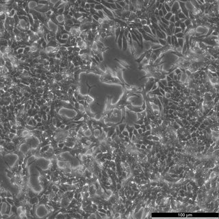 22RV1 cell