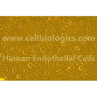 Human Primary Coronary Artery Endothelial Cells