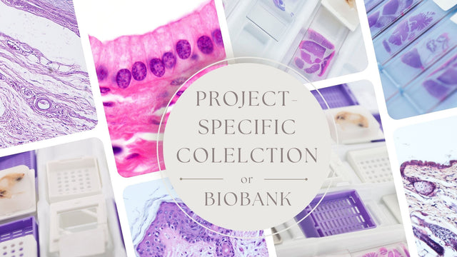 Advantages of Project-Specific Biospecimen Collection Over Biobanking