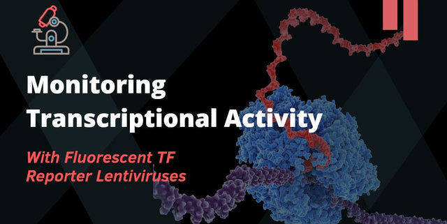 Transcription Factor Reporter Lentivirus: Monitor Signaling Pathway Activity in Living Cells
