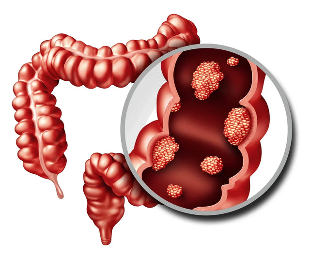 Colorectal Cancer Research: Cell Lines, Models, and Biomarkers
