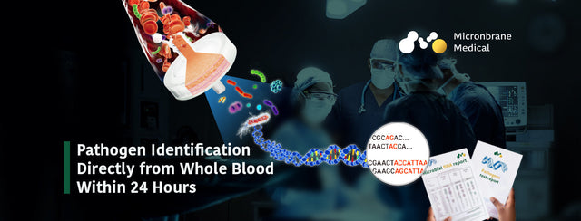 Optimizing Sequencing Costs in Metagenomics