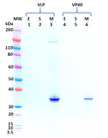 Mouse anti-MARV VP40 mAb (1D1) - Figure 1 of 1