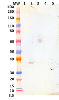 Chimeric anti-LukF mAb (051) - Figure 1 of 1