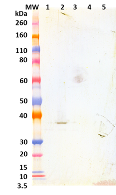 Chimeric anti-LukF mAb (051) - Figure 1 of 1