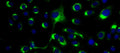 Anti-Dengue Virus Antibody, DE1 - Figure 1 of 1