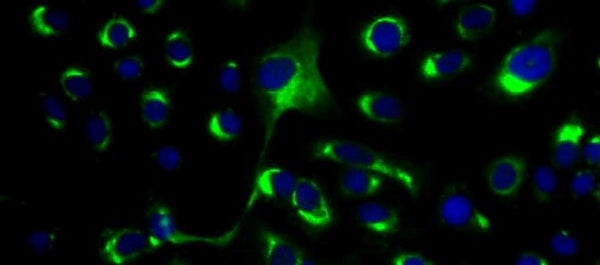 Anti-Dengue Virus Antibody, DE1 - Figure 1 of 1