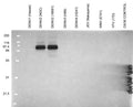 Anti-Dengue Virus NS1 Antibody, DN6 - Figure 1 of 1