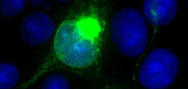 Anti-Japanese Encephalitis Virus Antibody, JE1 - Figure 1 of 1
