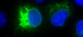 Anti-Japanese Encephalitis Virus NS1 Antibody, JN1 - Figure 1 of 1