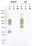 Rabbit anti-EBOV GP pAb - Figure 1 of 1