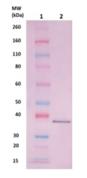 FhuD2 pAb (staph) - Figure 1 of 1