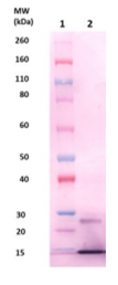 EsxB pAb (staph) - Figure 1 of 1