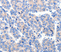 KCNH8 Polyclonal Antibody – Figure 1 of 3