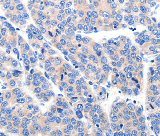 KCNH8 Polyclonal Antibody – Figure 1 of 3
