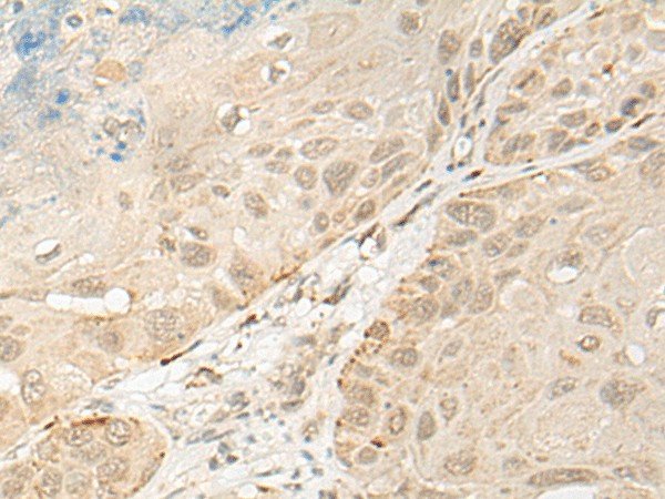 OTX1 Polyclonal Antibody – Figure 1 of 3