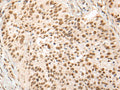 HOXA7 Polyclonal Antibody – Figure 1 of 2