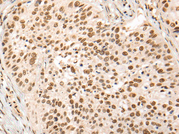HOXA7 Polyclonal Antibody – Figure 1 of 2