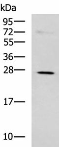 NQO2 Polyclonal Antibody – Figure 1 of 4