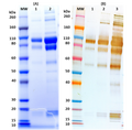 Recombinant Zaire Ebola virus GPΔTM (Makona Strain) - Figure 1 of 1