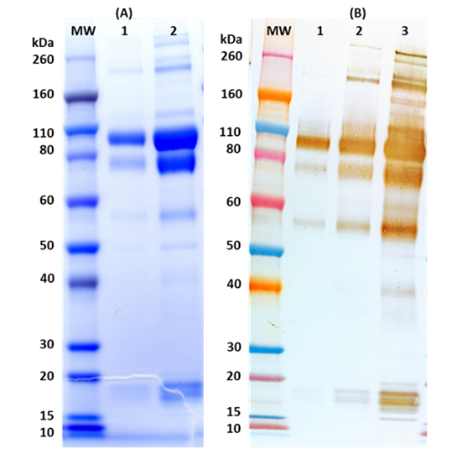 Recombinant Zaire Ebola virus GPΔTM (Makona Strain) - Figure 1 of 1