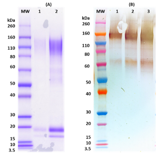 SUDV GPΔTM (mammalian)  HIS-tag - Figure 1 of 1