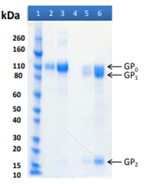 Recombinant Reston Ebola virus GPΔTM - Figure 1 of 1