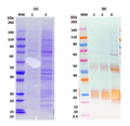 Recombinant Angola Marburg virus GPΔTM - Figure 1 of 1