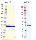 Recombinant LukF-PV (His-tagged, C-terminus) - Figure 1 of 1
