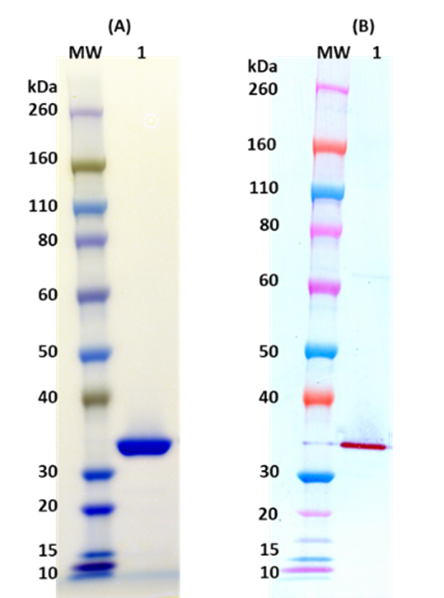 Recombinant LukS-PV (tag free) - Figure 1 of 1