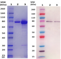 IsdB protein (staph) - Figure 1 of 1