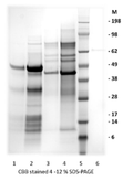 Recombinant Zika Ev2-dimer (S2) protein - Figure 1 of 1