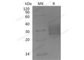 Recombinant Mouse TGFBR2 Protein (His Tag) – Figure 1 of 3
