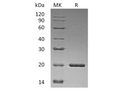 Recombinant Human Sonic Hedgehog/SHH Protein – Figure 1 of 2