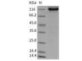 Recombinant Rat Tie2/TEK Protein (Fc Tag) – Figure 1 of 2