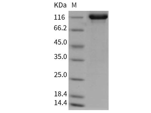Recombinant Rat Tie2/TEK Protein (Fc Tag) – Figure 1 of 2
