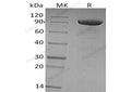 Recombinant Human Tie1 Protein (His Tag) – Figure 1 of 2
