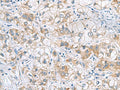 GCSH Polyclonal Antibody – Figure 1 of 3