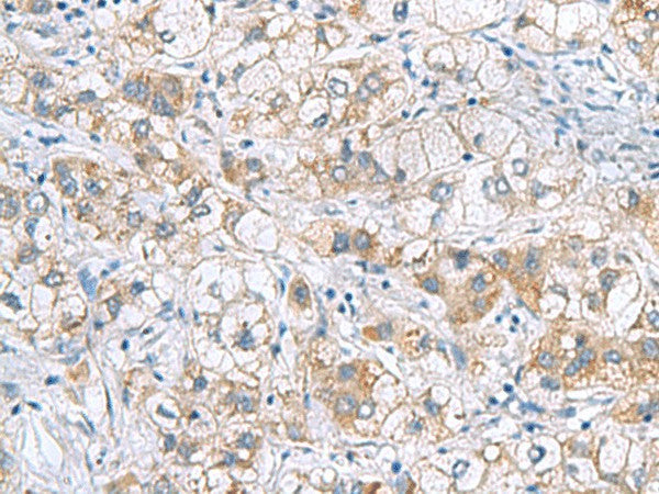 GCSH Polyclonal Antibody – Figure 1 of 3