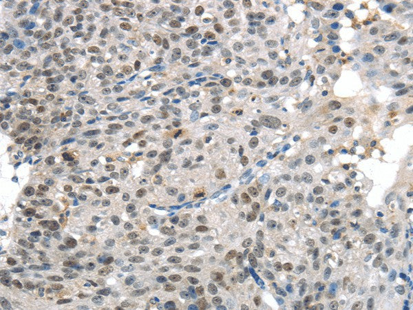 KDM5C Polyclonal Antibody – Figure 1 of 3
