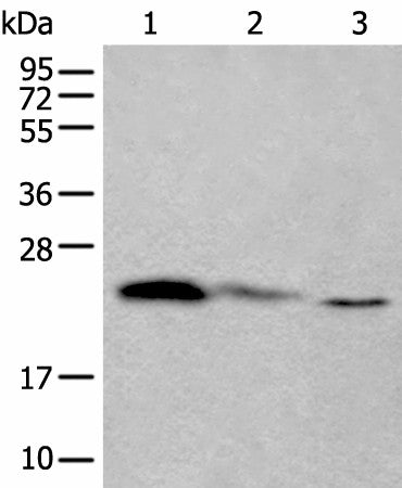 TPT1 Polyclonal Antibody – Figure 1 of 4