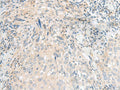 CALCOCO1 Polyclonal Antibody – Figure 1 of 3