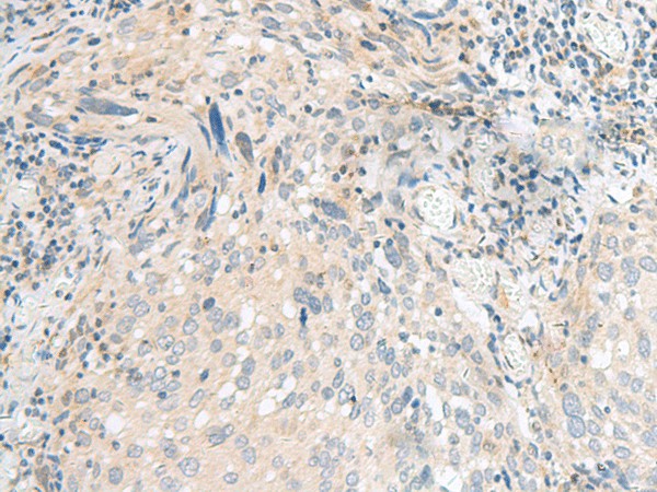 CALCOCO1 Polyclonal Antibody – Figure 1 of 3