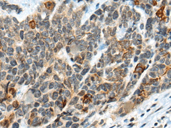 ATRX Polyclonal Antibody – Figure 1 of 3