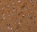 CYBB Polyclonal Antibody – Figure 1 of 3