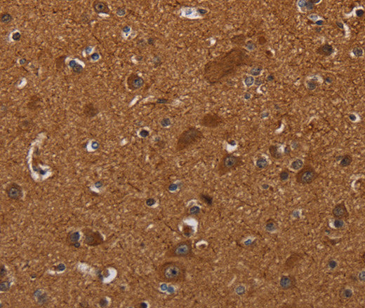 CYBB Polyclonal Antibody – Figure 1 of 3