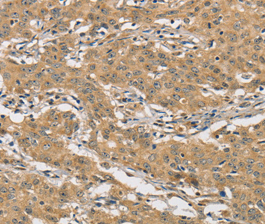 AMZ2 Polyclonal Antibody – Figure 1 of 3