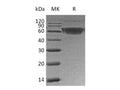 Recombinant Human PD-1/PDCD1 Protein (mFc Tag) – Figure 1 of 2