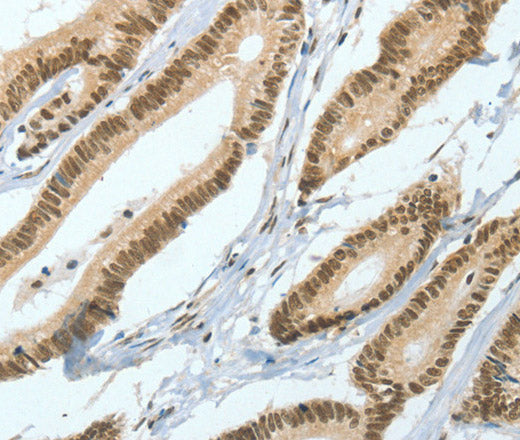 ASH2L Polyclonal Antibody – Figure 1 of 3